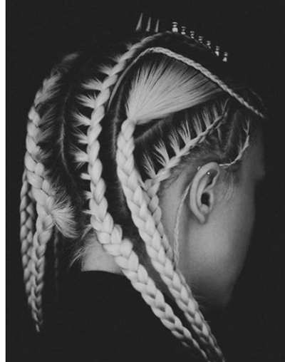 Hairstyles Such As Tight Braids and French Plaits Can Cause Traction Alopecia Hair Loss