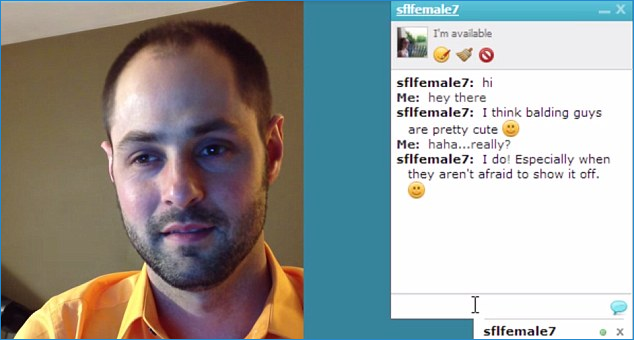 Dating Site Asks Users To Reveal Imperfections Including Balding