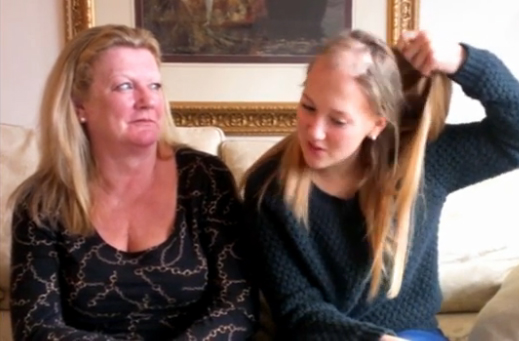 Emma Turner Starts Alopecia Areata Support Group in Portsmouth With Mum, Jackie