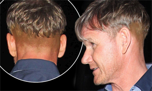 Gordon Ramsay Sparked More Hair Transplant Rumours After Attending Victoria Beckham's 40th Birthday Party in May 2014