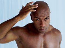 Male Hair Loss in Afro-Caribbean Men