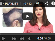 VIDEO - Information About Alopecia Areata