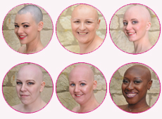 Pretty Bald Fundraising Alopecia Calendar 2015