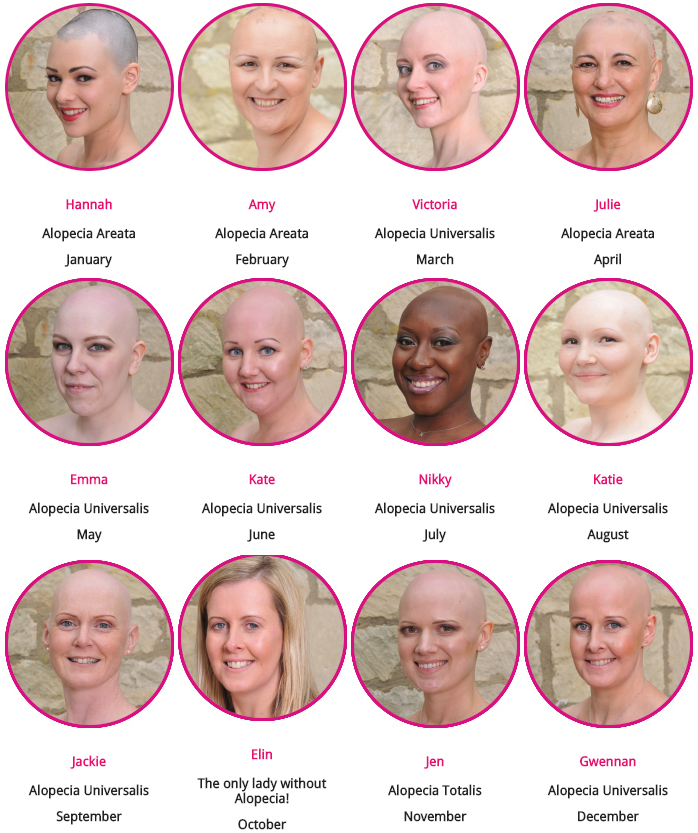 Pretty Bald Alopecia Calendar Girls 2015