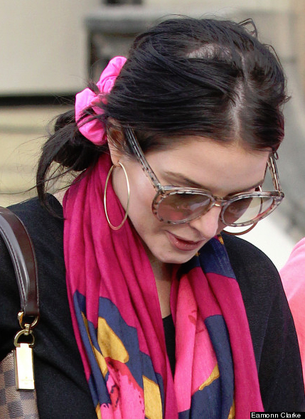 Helen Flanagan Shows Hair Loss Thought to be Caused By Hair Extensions