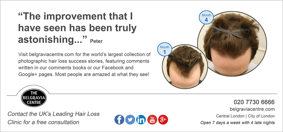 Belgravia Centre Hair Loss Clinics Tube Adverts August 2014 Male Pattern Hair Loss Treatment Success Story