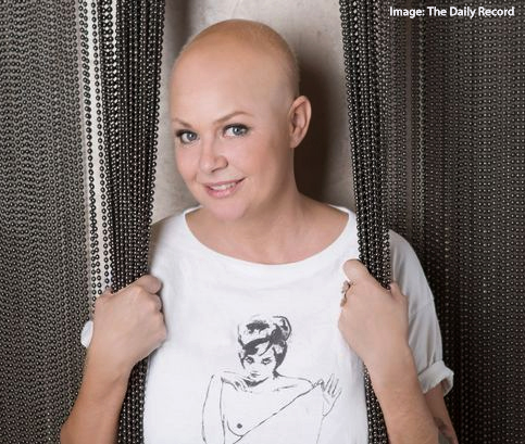 Gail Porter Talks Life, Work and Alopecia
