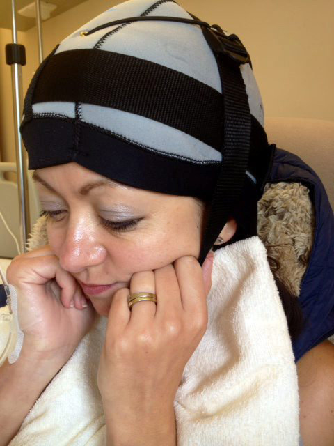 Shelley Cain Uses Head Freezing Cold Cap Therapy to Stop Her Hair Falling Out During Treatment for Breast Cancer
