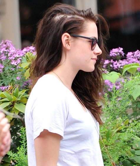 Kristen Stewart Female Pattern Hair Loss The Belgravia Centre