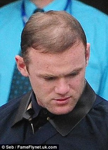 Wayne Rooney Reveals Thinning Hair Despite Hair Transplant