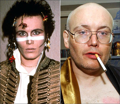 Adam Ant Hairline now and then The Belgravia Centre