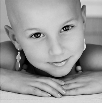 Child with alopecia