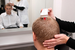 treatment for male pattern baldness