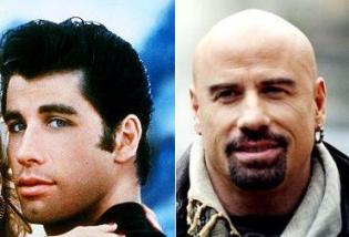 John Travota in Grease and now bald