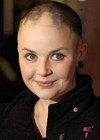 After Losing All Her Hair to Alopecia Areata in 2004, Gail Porter's Eyebrows and Eyelashes Have Regrown as Have Patches of Her Scalp Hair.