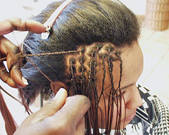 Afro-Caribbean Hair is Particularly Susceptible to Traction Alopecia, Which Can Be Caused by Braiding and Other Styling Aids.