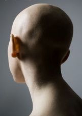 Hair Loss from Cancer Treatment may be Prevented