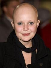 Gail Porter has alopecia areata