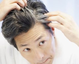 Grey hair and hair loss are genetic conditions