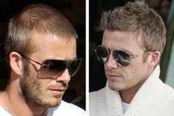 Baldness is not in this man's vocabulary - David Beckham's thinning hair is a thing of the past