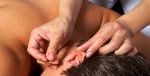 Acupuncture for hair loss