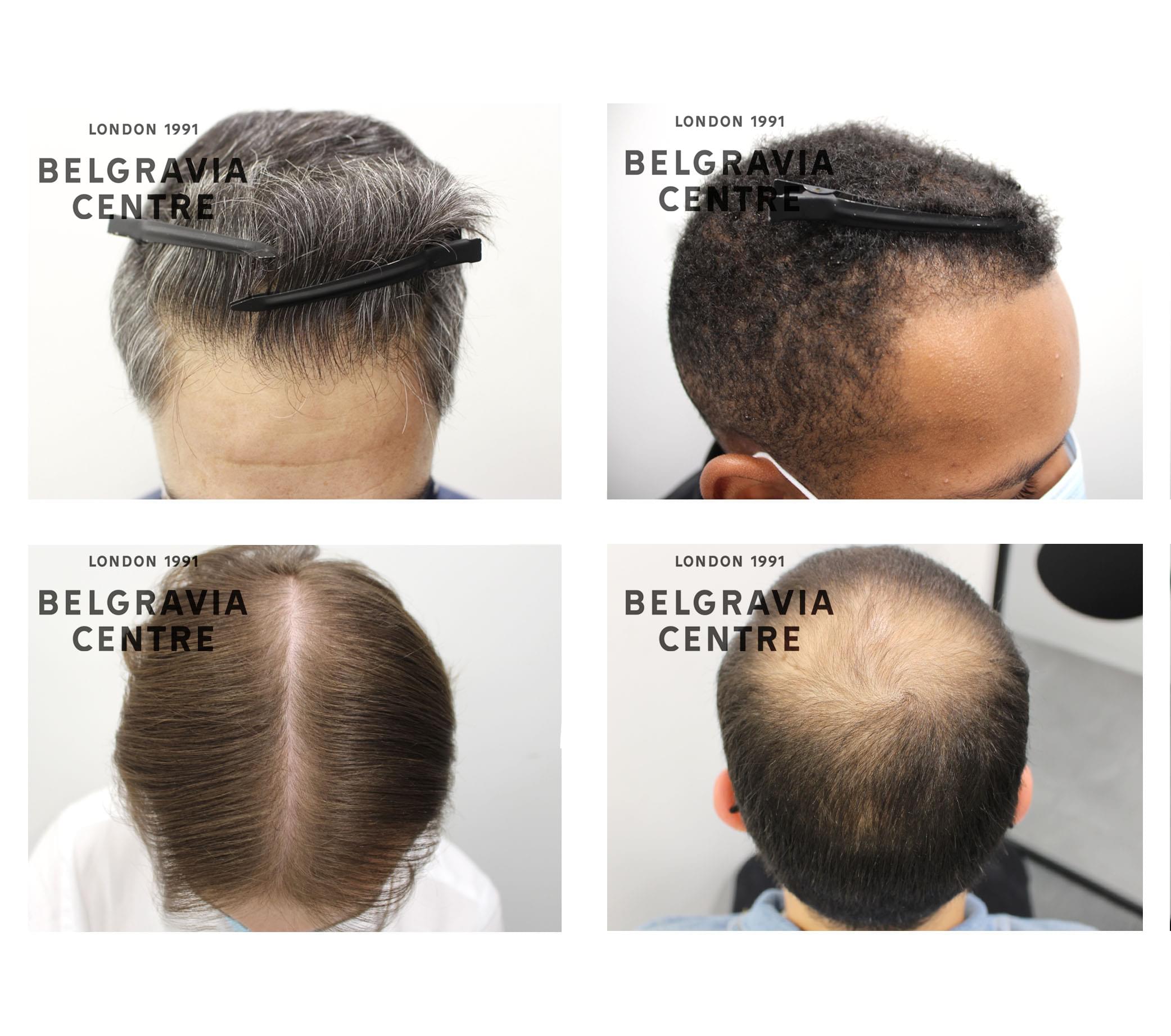 3 images from above,front and back of a male person