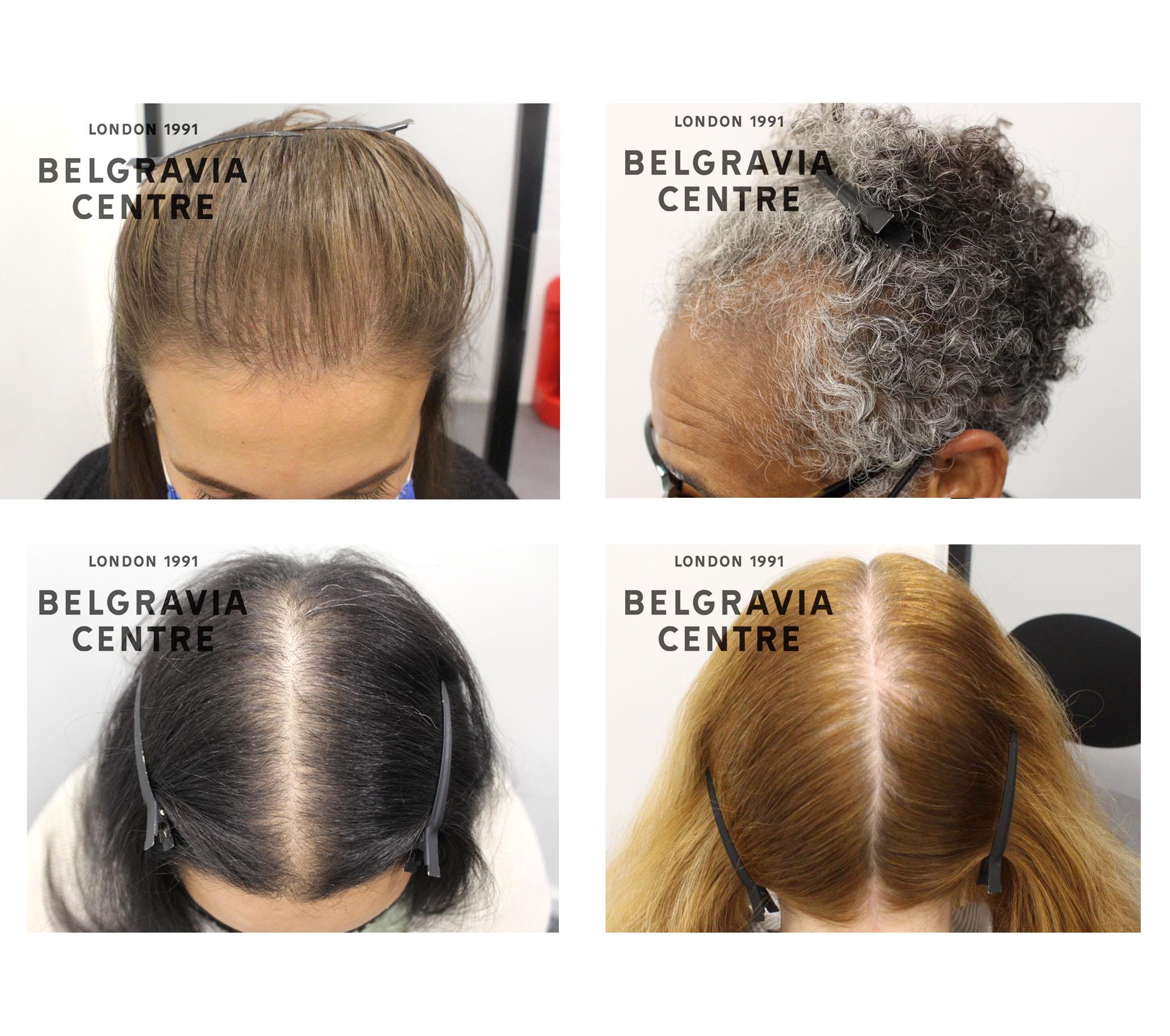 3 images from above,front and back of a female person