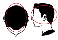 On the top and sides of your head (all over scalp)