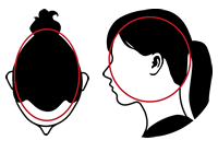 On the top and sides of your head (all over scalp)